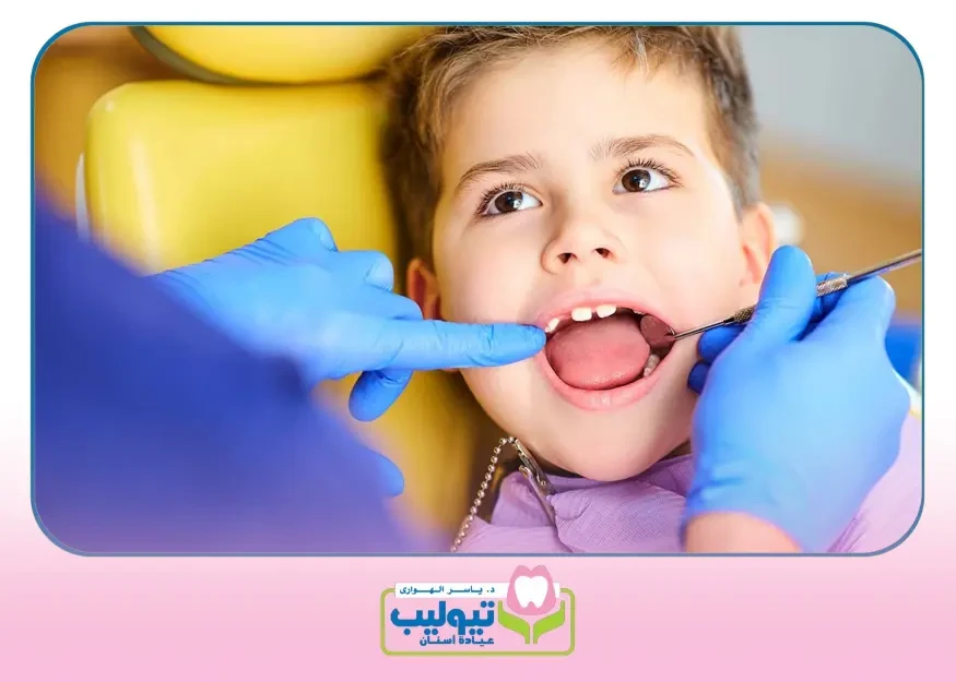 تعديل الأسنان بالتقويم image